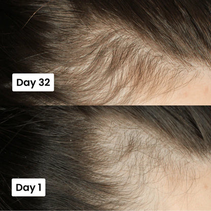 Scalp Hair Growth Serum